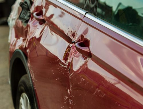 Different Types of Dents